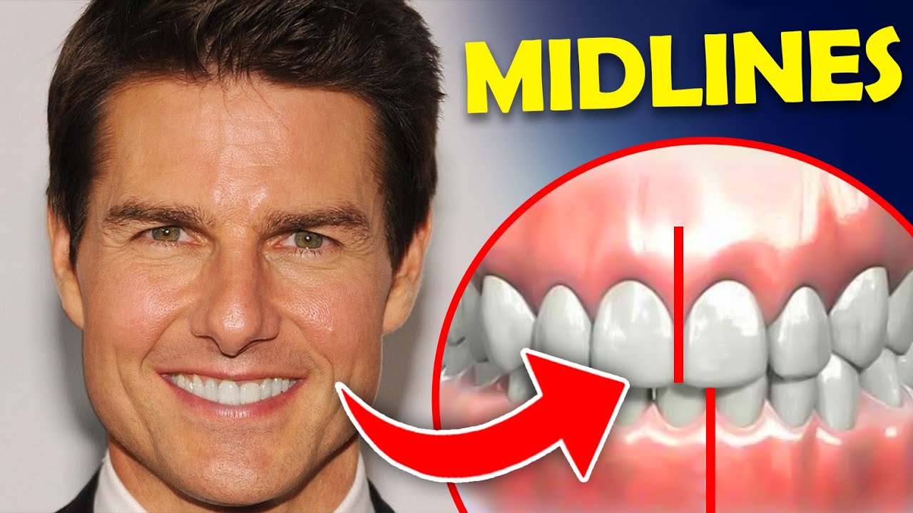 Why Tom Cruise's teeth look off - how to fix a midline