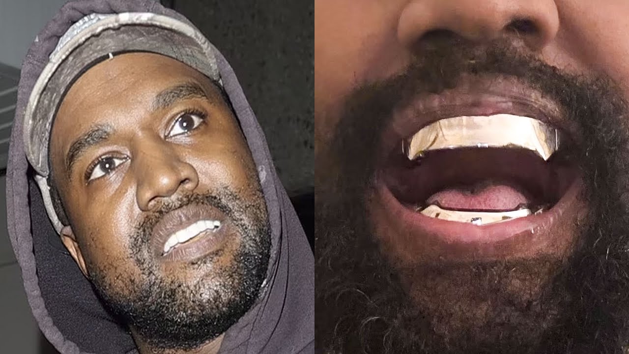 Kanye PULLED His Teeth And Replaced With Titanium!