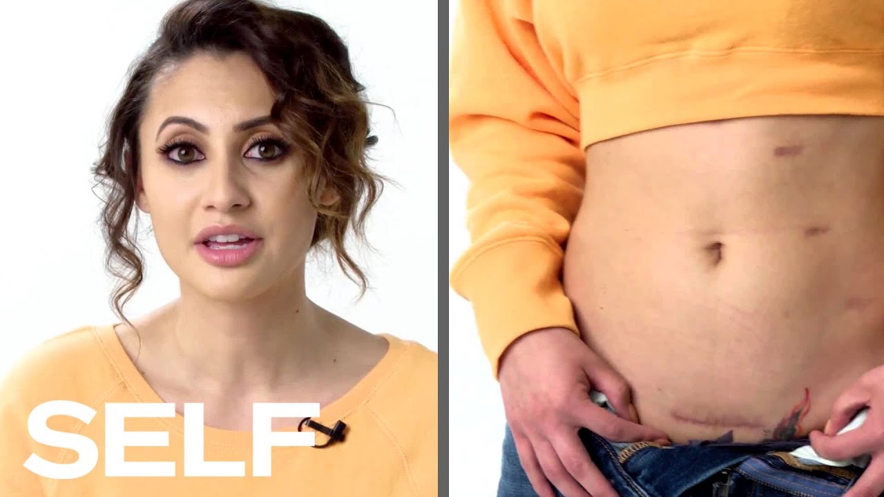 Francia Raisa Explains How She Became Selena Gomez's Kidney Donor | Body Stories | SELF