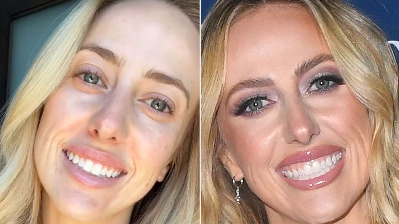 Brittany Mahomes Reveals She's 'Really Struggling' with Acne Breakout in New Makeup-Free Selfies