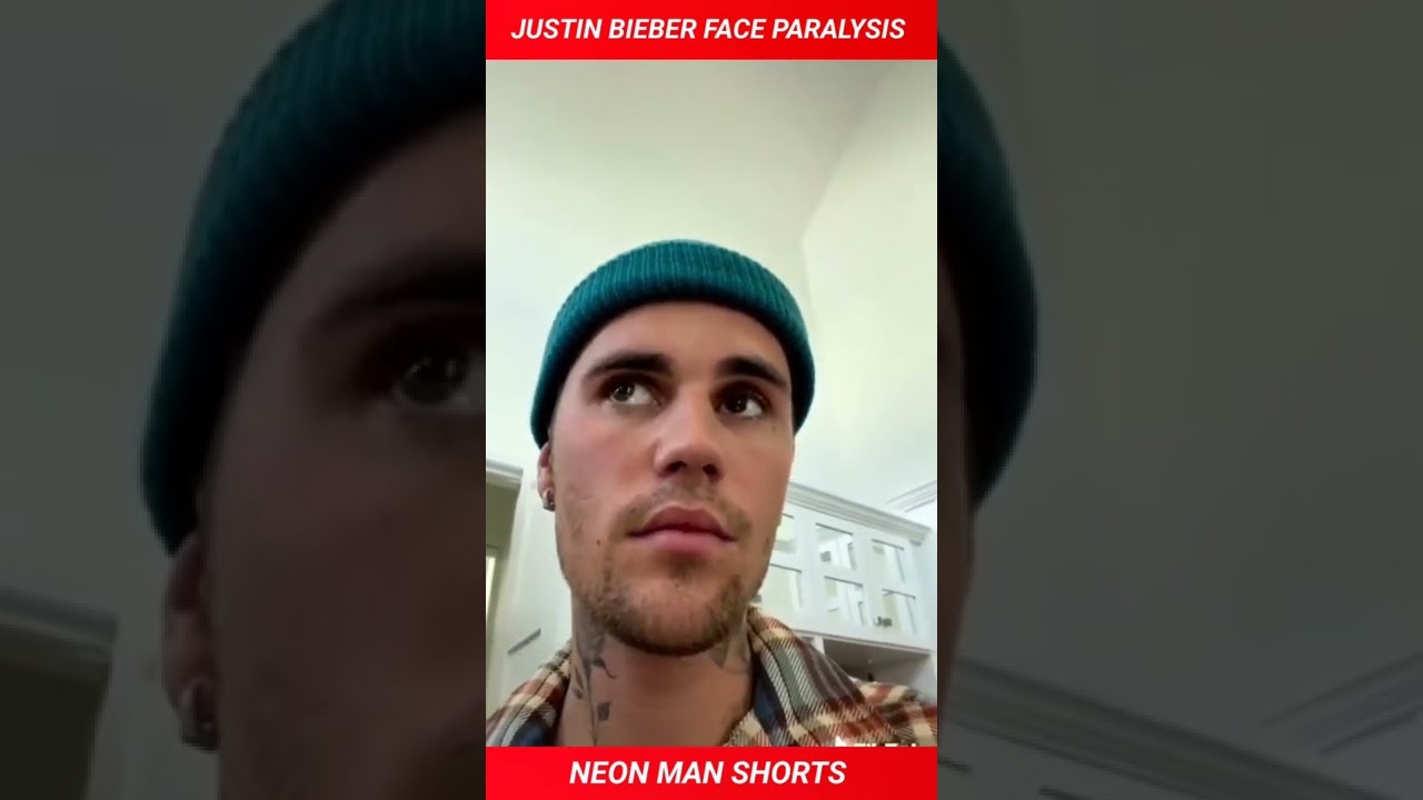 @Justin Bieber Face Paralysis! Justin Bieber SERIOUS Physical Syndrome| Justin Bieber Facts #shorts