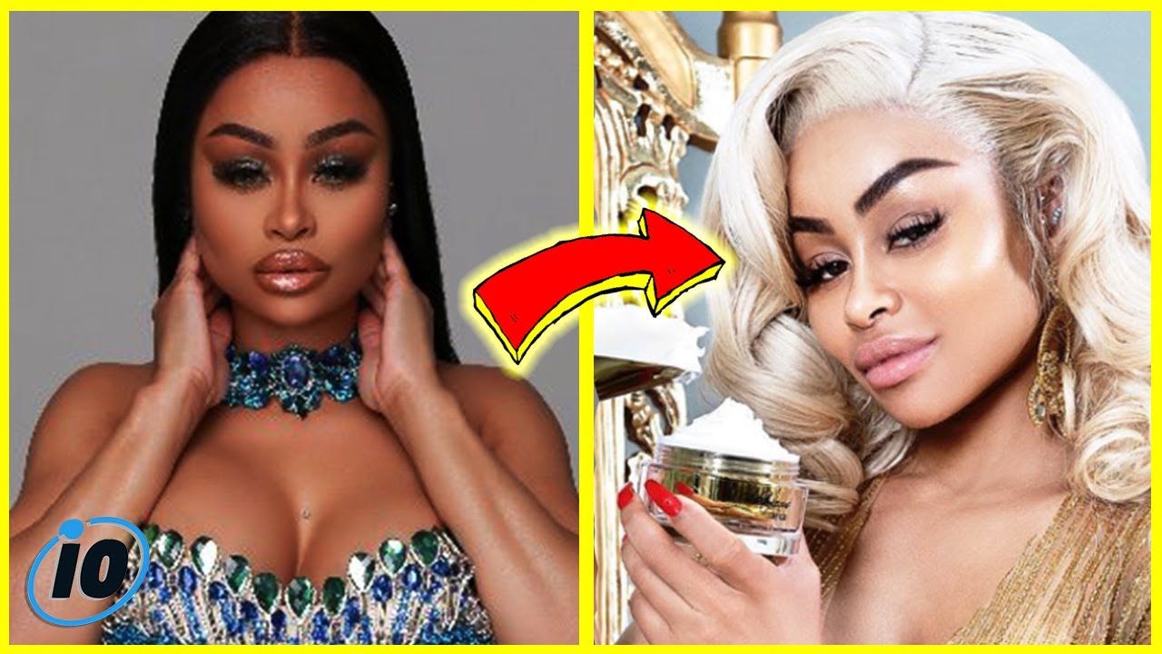 Top 10 Celebrities Accused Of Lightening Their Skin