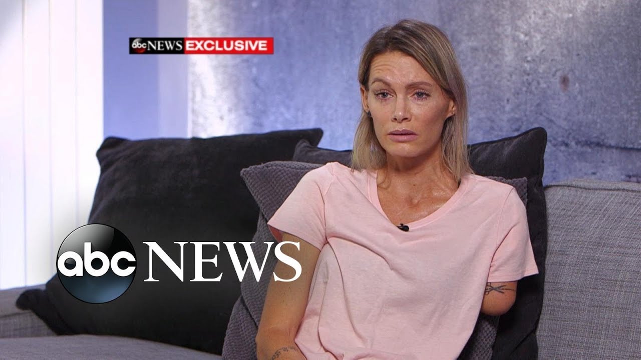 'Resident Evil' stuntwoman speaks out about injury, lawsuit l ABC News
