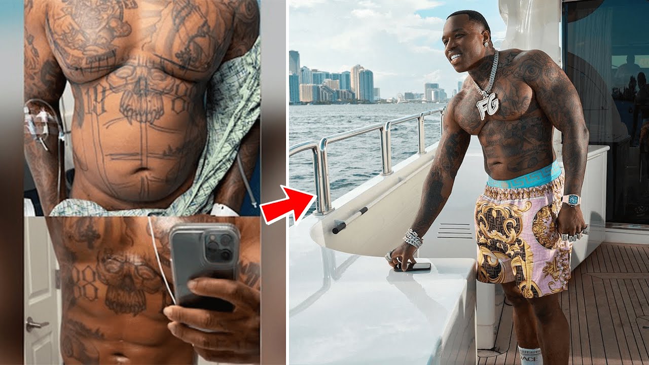 10 Male Celebrities who have had liposuction
