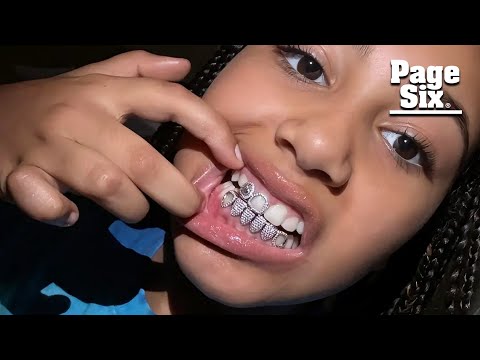 North West, 10, shows off diamond grills as dad Kanye debuts $850K titanium dentures
