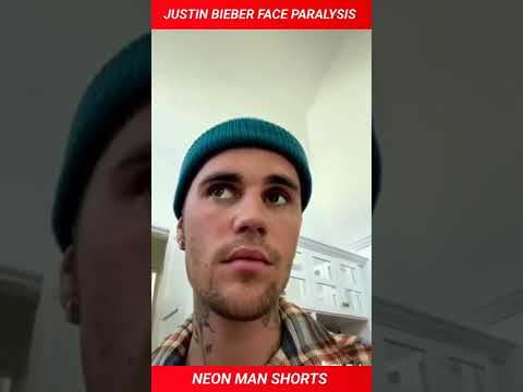 @Justin Bieber Face Paralysis! Justin Bieber SERIOUS Physical Syndrome| Justin Bieber Facts #shorts