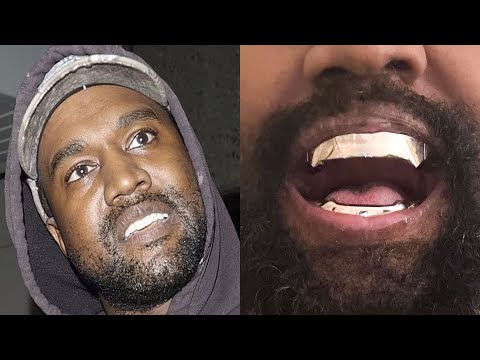 Kanye PULLED His Teeth And Replaced With Titanium!