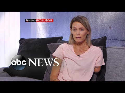 'Resident Evil' stuntwoman speaks out about injury, lawsuit l ABC News