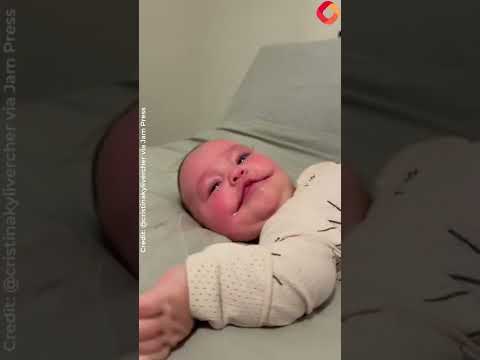 My daughter was born with a PERMANENT SMILE – I'm sharing my experience to help others