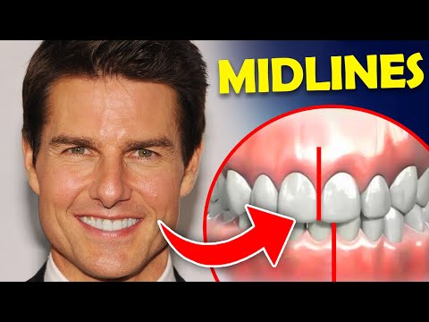 Why Tom Cruise's teeth look off - how to fix a midline