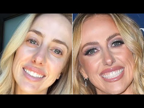 Brittany Mahomes Reveals She's 'Really Struggling' with Acne Breakout in New Makeup-Free Selfies