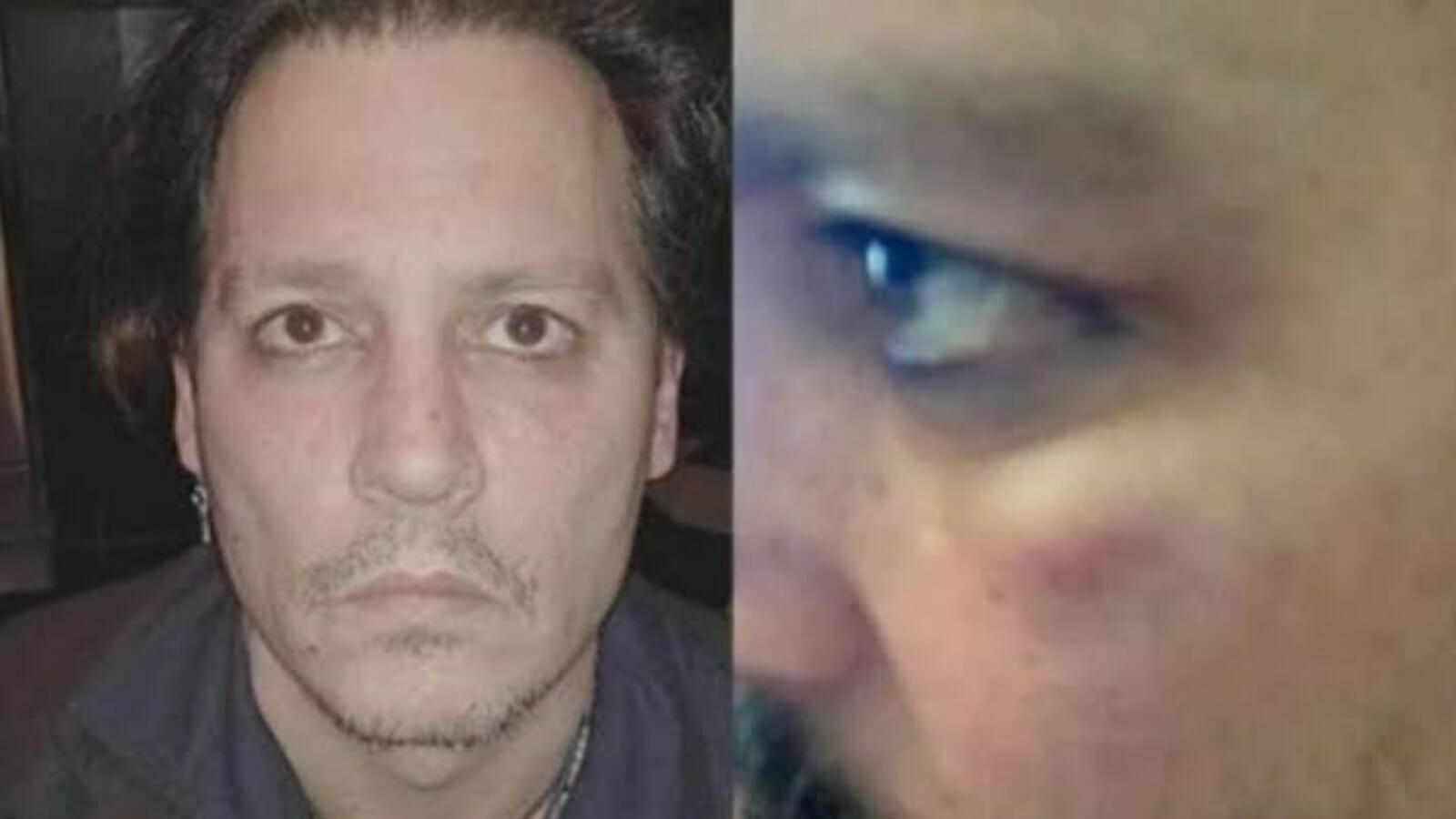 Johnny Depp's bruised face photo presented in the court
