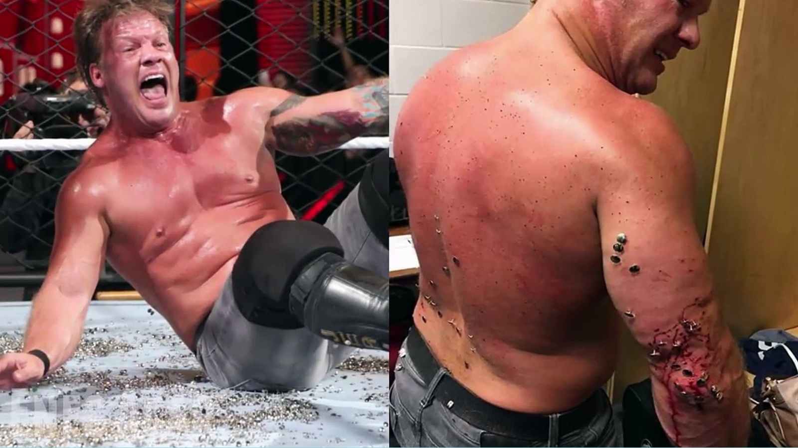 WWE Real Injury